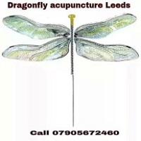 Dragonfly acupuncture Leeds
